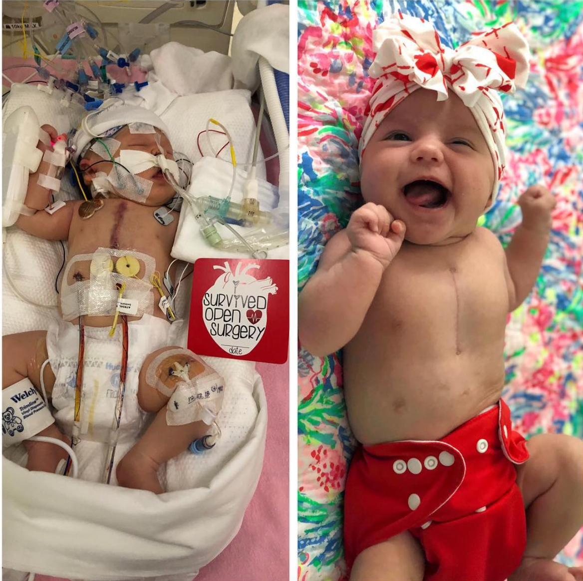 CHD Heart Warrior Plastic Milestone Cards